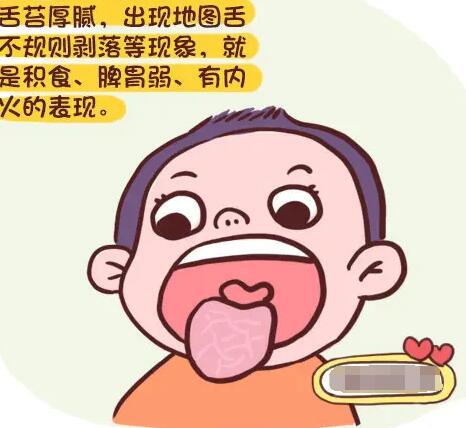 中医体质辨识系统提醒咳嗽痰多、舌苔厚腻，可能是积食了！